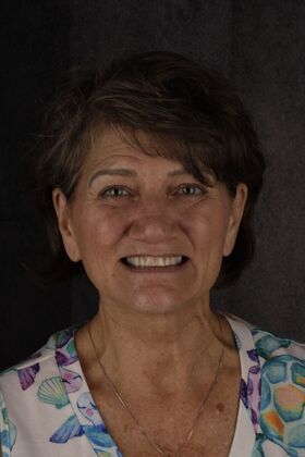 Our Smile Transformations Jill - Before