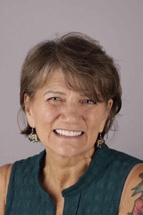 Our Smile Transformations Jill - After