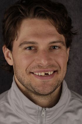 Our Smile Transformations Gage - Before