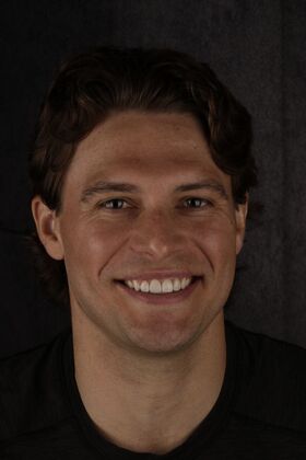 Our Smile Transformations Gage - After