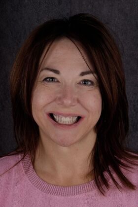 Our Smile Transformations Christine - Before