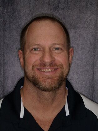 Our Smile Transformations Brent - Before