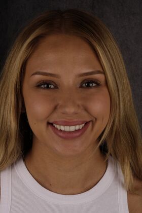 Our Smile Transformations Anna - Before