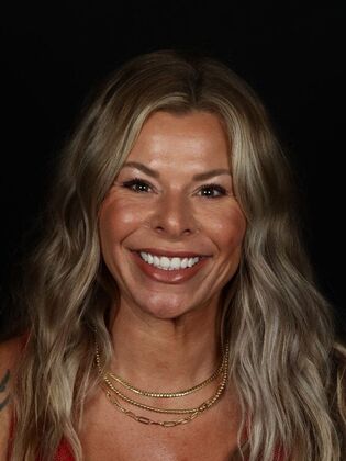 Full Mouth Rehabilitation Kinslie - After