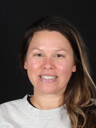 Porcelain Veneers: Alex - Before