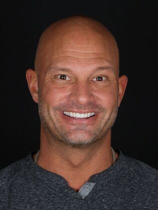 Porcelain Veneers: Kevin - Before