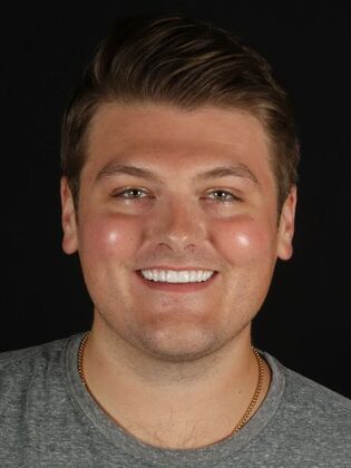 Full Mouth Rehabilitation: Justin - After