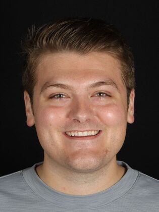 Full Mouth Rehabilitation: Justin - Before