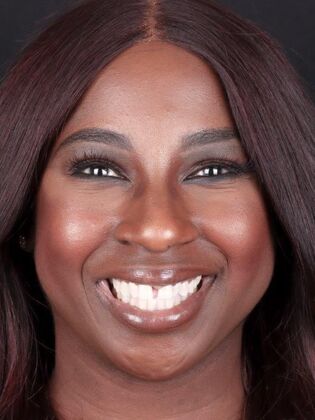 Smile Makeover & Veneers: Regina - Before