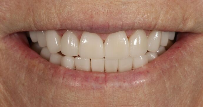Smile Transformations Cases