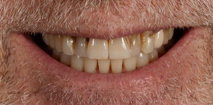 Smile Transformations Case 9 - Before