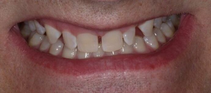 Smile Transformations Case 15 - Before