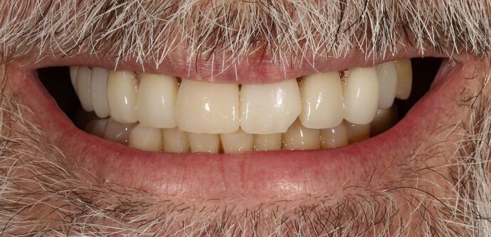 Smile Transformations Case 19 - Before