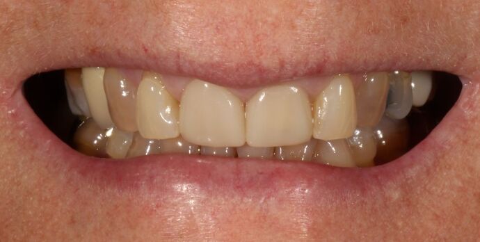 Smile Transformations Case 20 - Before