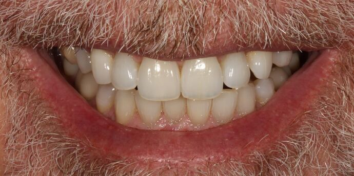 Smile Transformations Case 28 - Before