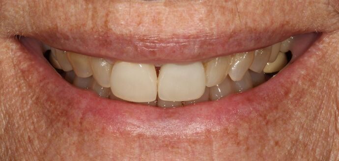 Smile Transformations Case 31 - Before