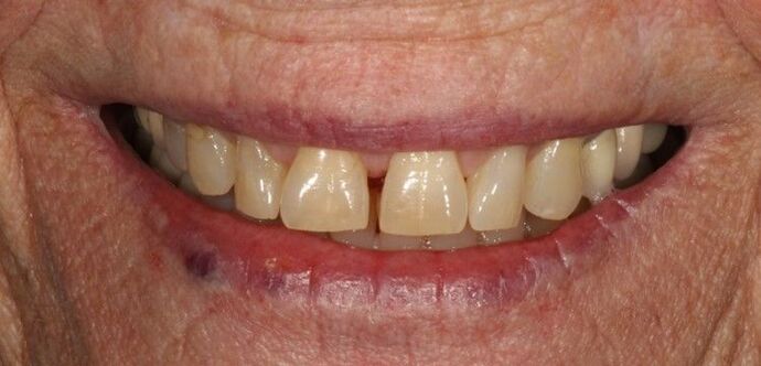 Smile Transformations Case 32 - Before