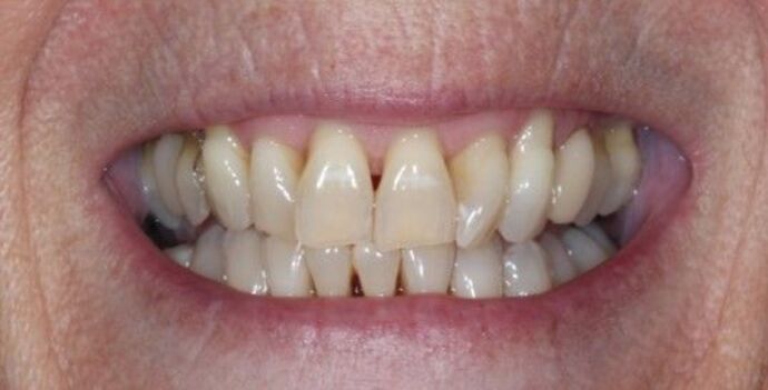 Smile Transformations Case 35 - Before