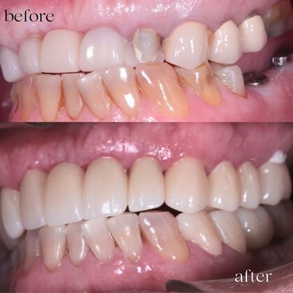 Before and After  Case 3