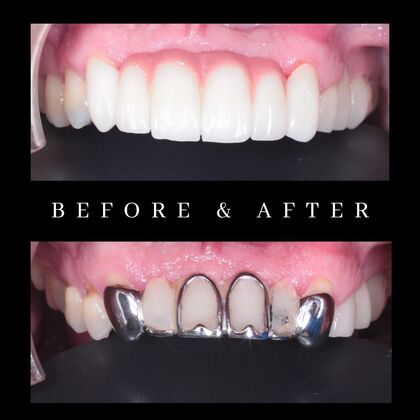 Before and After  Case 4