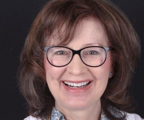 Smile Makeover & Veneers: Rebecca - After