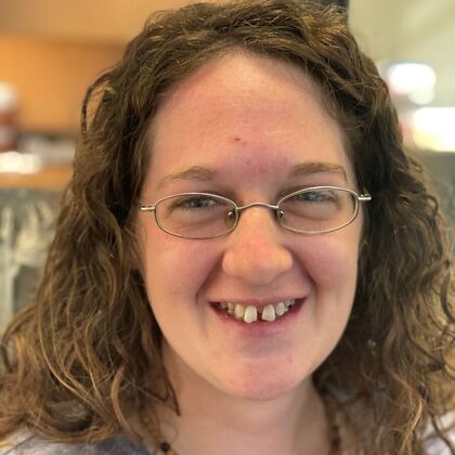 Dental Implants Case 7 - Before