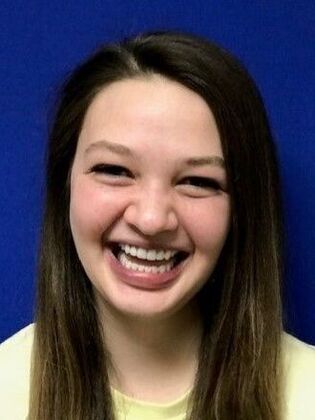 Dental Implants Case 3 - After