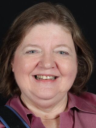 Dental Implants Suzanne - Before