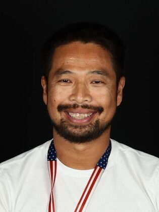 Porcelain Veneers: Vien - Before