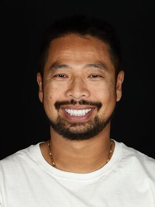 Porcelain Veneers: Vien - After