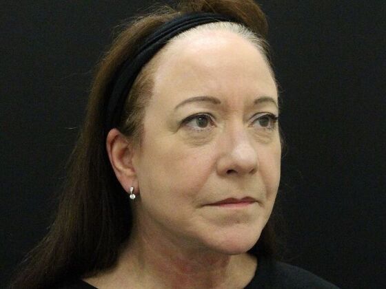 Face & Neck Lifts: Case 48 - After