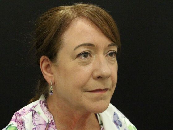 Face & Neck Lifts: Case 48 - Before