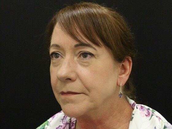 Face & Neck Lifts: Case 48 - Before