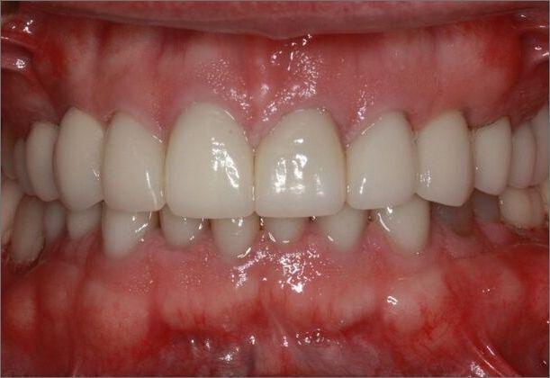 Cosmetic Case 7 - After