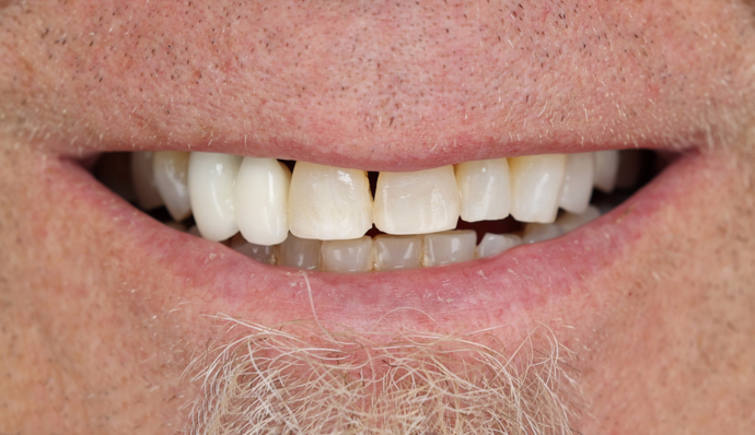 Smile Transformations Richard - After