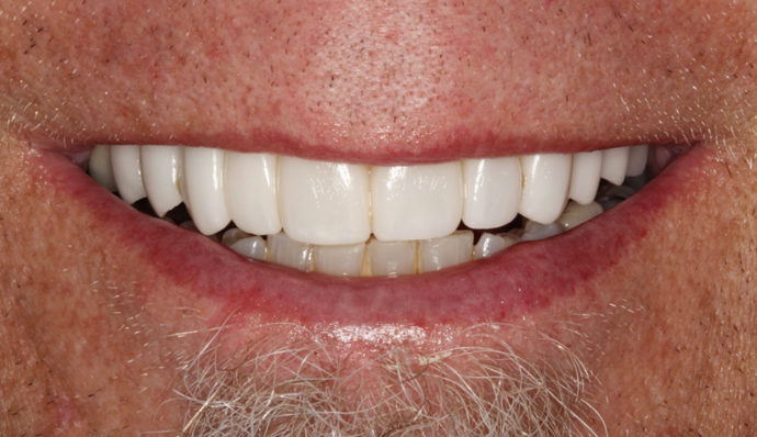 Smile Transformations Richard - Before