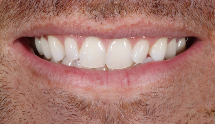 Smile Transformations Greg - Before