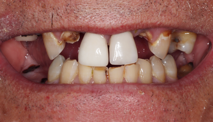 Smile Transformations Carl - Before