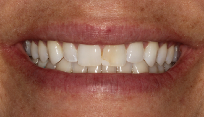 Smile Transformations Aja - Before