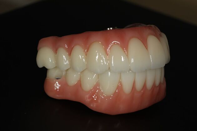 All-on-4 / All-on-X: Case 10 - After