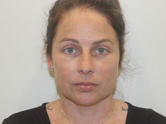 Injectables: Case 86 - Before