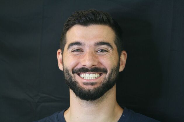 Porcelain Veneers: Case 7 - After