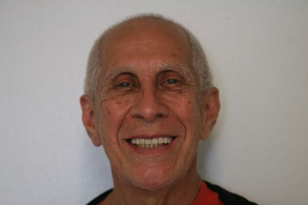 Dental Implants: Case 3 - After