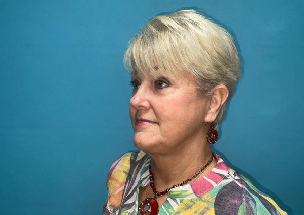 Facelift: Case 2 - After