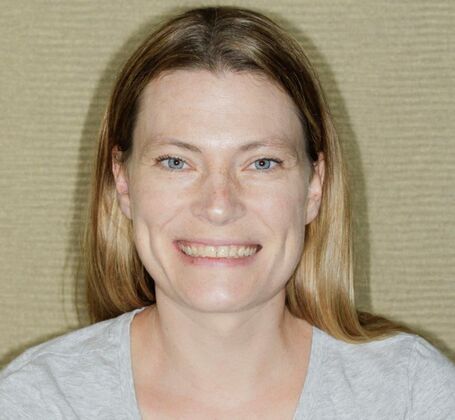 Smile Makeover & Veneers: Brynn - Before