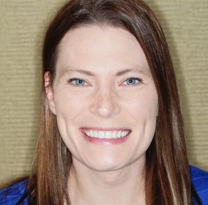 Smile Makeover & Veneers: Brynn - After