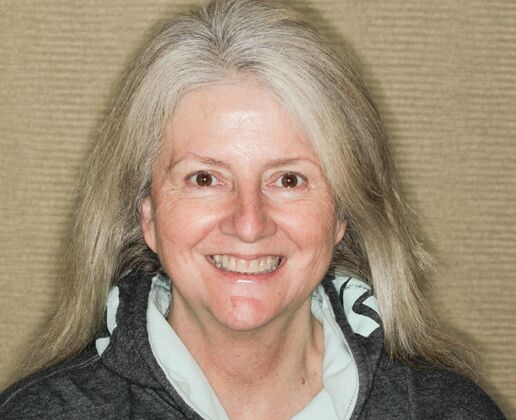 Smile Makeover & Veneers: Britney - Before