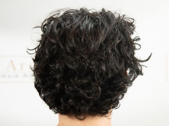 FUT Hair Restoration: Case 48 - After