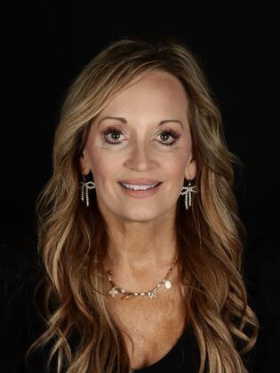 Porcelain Veneers: Natalie - Before