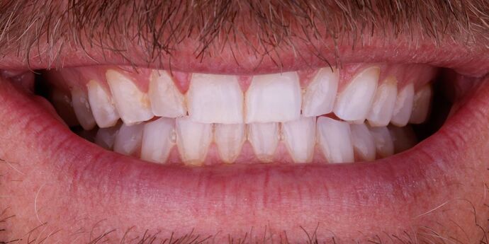 Smile Design Cases Case 8 - Before